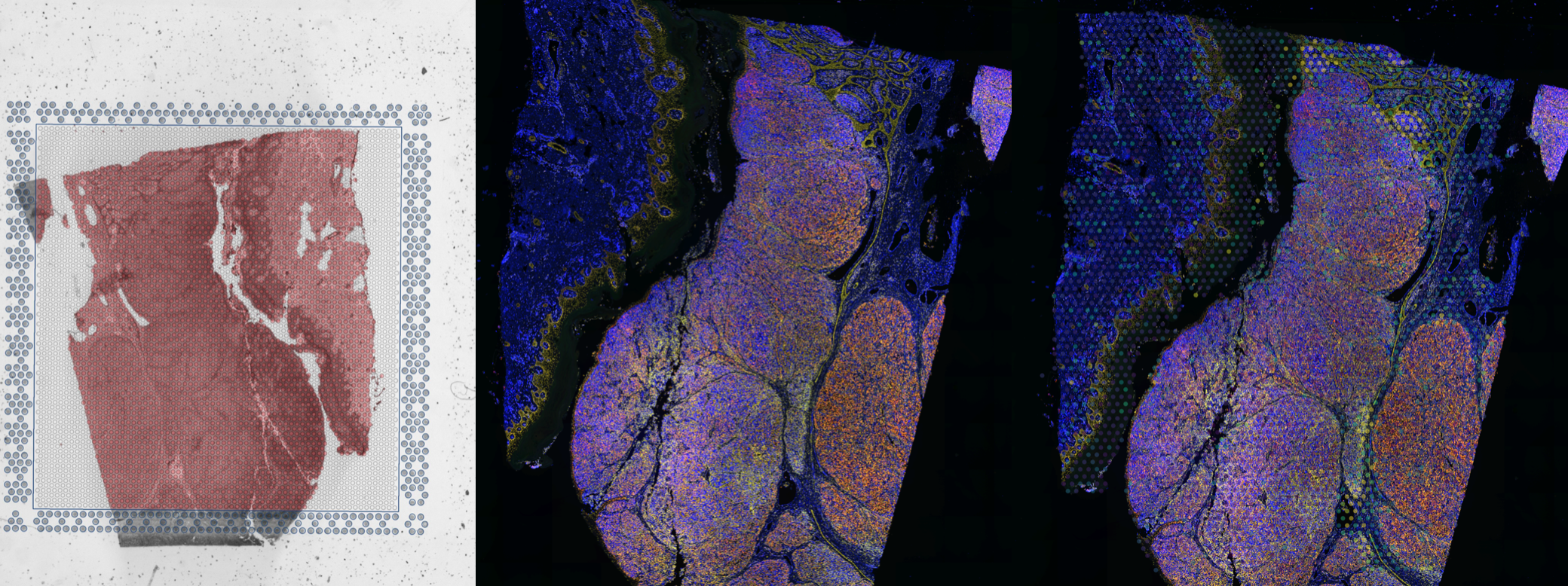 Spatial transcriptomics visualisation